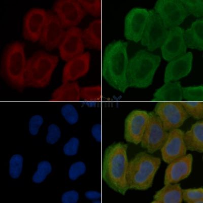 SOD2/MnSOD Antibody - AF5144 staining Hela cells(30min of UV treatment) by IF/ICC.