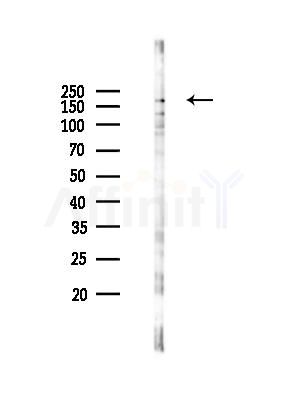 ZO 1 Antibody - Western blot analysis of lysates from 293 cells(heat-shock 45min treatment), using ZO 1 Antibody at 1/1000 dilution.