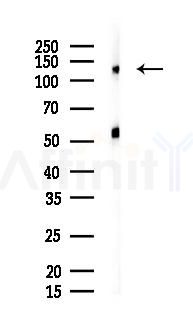 Integrin  alpha E Antibody - Western blot analysis of lysates from Rat liver, using Integrin  alpha E Antibody at 1/1000 dilution.
