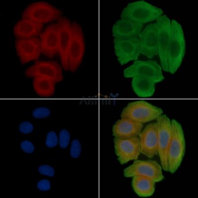 Annexin III Antibody - AF5159 staining Hela cells(30min of UV treatment) by IF/ICC.