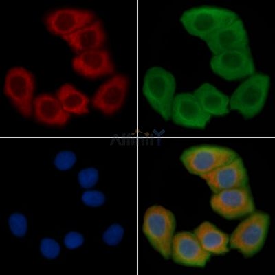 Interferon gamma Antibody - AF5183 staining Hela cells(30min of UV treatment) by IF/ICC.