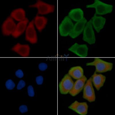 MDR1 Antibody - AF5185 staining Hela cells(30min of UV treatment) by IF/ICC.