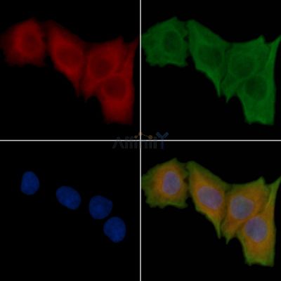 Cathepsin B Antibody - AF5189 staining Hela cells(30min of UV treatment) by IF/ICC.