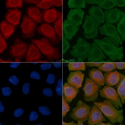 VEGFD Antibody - AF5192 staining Hela cells(30min of UV treatment) by IF/ICC.