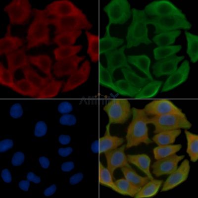 TOMM20 Antibody - AF5206 staining Hela cells(30min of UV treatment) by IF/ICC.