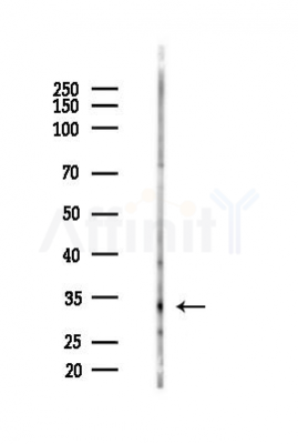 HOXB5 Antibody - Western blot analysis of lysates from K562 cells(LPS 4h treatment), using HOXB5 Antibody at 1/1000 dilution.
