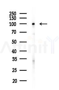 SOX6 Antibody - Western blot analysis of lysates from PC12 cells(heat-shock 45min treatment), using SOX6 Antibody at 1/1000 dilution.