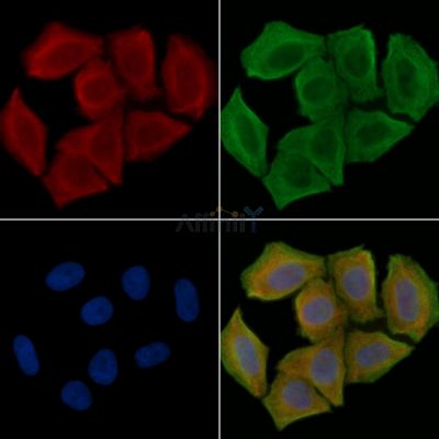 Cytochrome P450 19A1 Antibody - AF5229 staining Hela cells(30min of UV treatment) by IF/ICC.