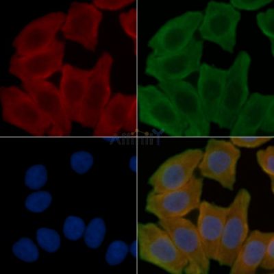 SIRT2 Antibody - AF5256 staining Hela cells(30min of UV treatment) by IF/ICC.