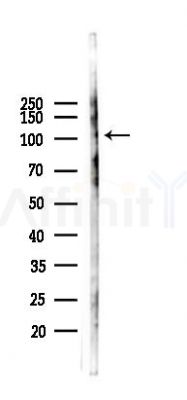 Cleaved-Notch2 (Asp1733) Antibody - Western blot analysis of lysates from 293 cells(LPS 4h treatment), using Cleaved-Notch2 (Asp1733) Antibody at 1/1000 dilution.