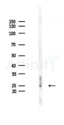 Calsenilin/KCNIP3 Antibody - Western blot analysis of lysates from Rat kidney, using Calsenilin/KCNIP3 Antibody at 1/1000 dilution.