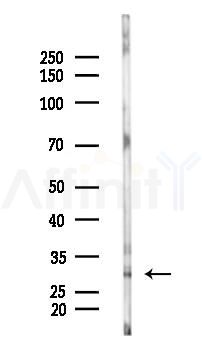 Cyclin C Antibody - Western blot analysis of lysates from COLO205 cells(heat-shock 45min treatment), using Cyclin C Antibody at 1/1000 dilution.