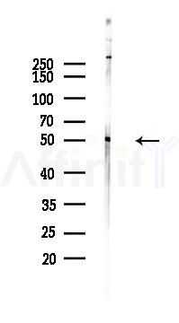 Caspase 1 Antibody - Western blot analysis of lysates from HUVEC cells(UV 30min treatment), using Caspase 1 Antibody at 1/1000 dilution.