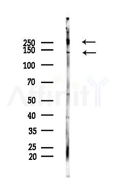 Collagen III Antibody - Western blot analysis of lysates from Mouse lung, using Collagen III Antibody at 1/1000 dilution.