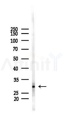 TSG6 Antibody - Western blot analysis of lysates from Rat lung, using TSG6 Antibody at 1/1000 dilution.