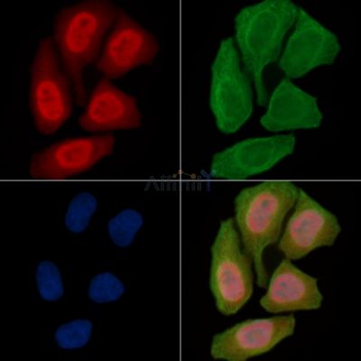 MSK1 Antibody - AF6031 staining Hela cells(30min of UV treatment) by IF/ICC.