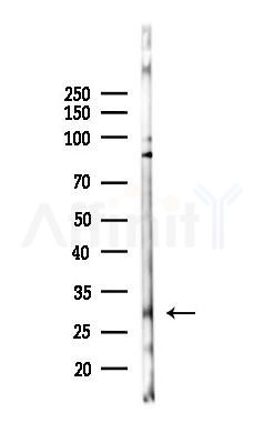 SNAIL Antibody - Western blot analysis of lysates from A2780 cells(LPS 4h treatment), using SNAIL Antibody at 1/1000 dilution.