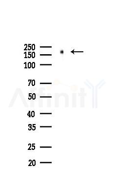 EGFR Antibody - Western blot analysis of lysates from HUVEC cells(LPS 4h treatment), using EGFR Antibody at 1/1000 dilution.