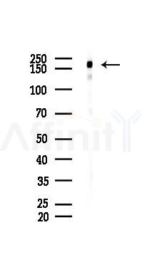 EGFR Antibody - Western blot analysis of lysates from HUVEC cells(UV 30min treatment), using EGFR Antibody at 1/1000 dilution.