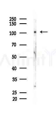 Retinoblastoma Antibody - Western blot analysis of lysates from 293 cells(heat-shock 45min treatment), using Retinoblastoma Antibody at 1/1000 dilution.