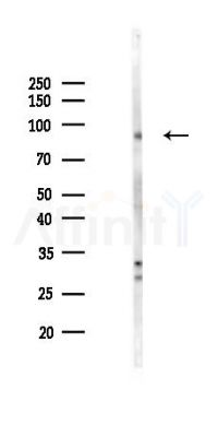 ADRB2 Antibody - Western blot analysis of lysates from K562 cells(LPS 4h treatment), using ADRB2 Antibody at 1/1000 dilution.