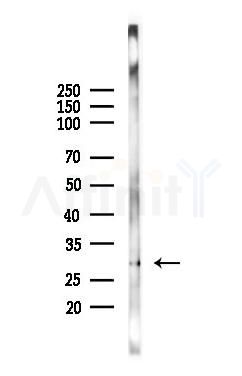 Bcl-2 Antibody - Western blot analysis of lysates from HUVEC cells(LPS 4h treatment), using Bcl-2 Antibody at 1/1000 dilution.