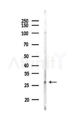 Bcl-2 Antibody - Western blot analysis of lysates from 293 cells(heat-shock 45min treatment), using Bcl-2 Antibody at 1/1000 dilution.
