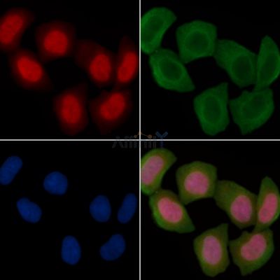 Histone H2A.X Antibody - AF6187 staining Hela cells(30min of UV treatment) by IF/ICC.