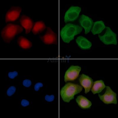 JunB Antibody - AF6198 staining Hela cells(30min of UV treatment) by IF/ICC.