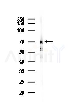 Synapsin I Antibody - Western blot analysis of lysates from Rat brain, using Synapsin I Antibody at 1/1000 dilution.