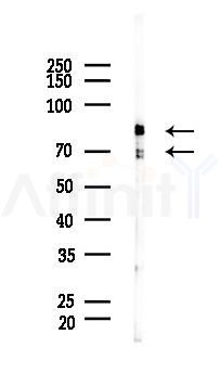 Synapsin I Antibody - Western blot analysis of lysates from Rat brain, using Synapsin I Antibody at 1/1000 dilution.