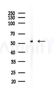 GABA A Receptor beta 1 Antibody - Western blot analysis of lysates from B16F10-LUC cells(UV 30min treatment), using GABA A Receptor beta 1 Antibody at 1/1000 dilution.