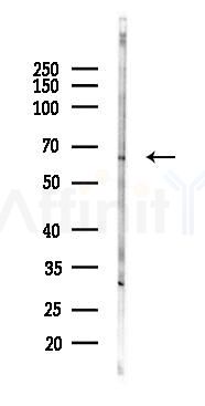 Epo-R Antibody - Western blot analysis of lysates from Hela cells(heat-shock 24h treatment), using Epo-R Antibody at 1/1000 dilution.