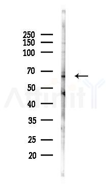 Epo-R Antibody - Western blot analysis of lysates from B16F10-LUC cells(UV 30min treatment), using Epo-R Antibody at 1/1000 dilution.
