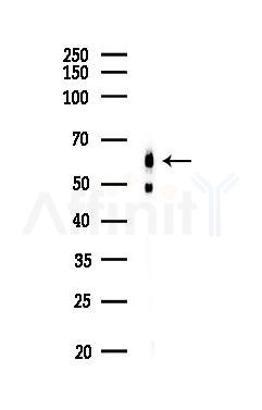 PI3K p85 alpha Antibody - Western blot analysis of lysates from Mouse testis, using PI3K p85 alpha Antibody at 1/1000 dilution.