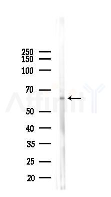 CDC25A Antibody - Western blot analysis of lysates from PC12 cells(heat-shock 45min treatment), using CDC25A Antibody at 1/1000 dilution.