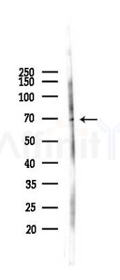 CDC25A Antibody - Western blot analysis of lysates from 293 cells(LPS 4h treatment), using CDC25A Antibody at 1/1000 dilution.
