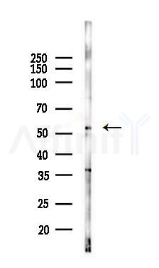 pan-AKT1/2/3 Antibody - Western blot analysis of lysates from 293 cells(heat-shock 45min treatment), using pan-AKT1/2/3 Antibody at 1/1000 dilution.