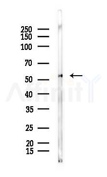 pan-AKT1/2/3 Antibody - Western blot analysis of lysates from Mouse testis, using pan-AKT1/2/3 Antibody at 1/1000 dilution.