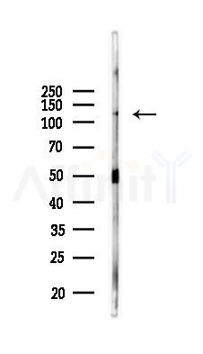 VE-Cadherin Antibody - Western blot analysis of lysates from Rat brain, using VE-Cadherin Antibody at 1/1000 dilution.