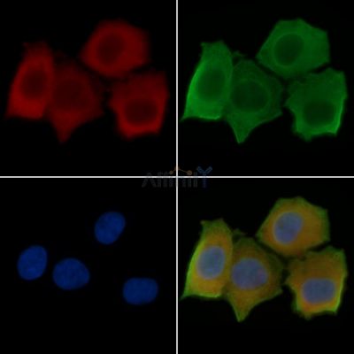 VE-Cadherin Antibody - AF6265 staining Hela cells(30min of UV treatment) by IF/ICC.