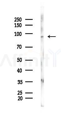 beta Catenin Antibody - Western blot analysis of lysates from Mouse lung, using beta Catenin Antibody at 1/1000 dilution.