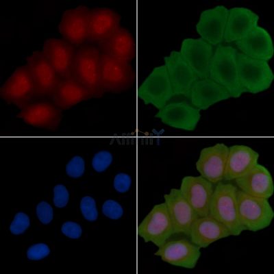 IRS1 Antibody - AF6273 staining Hela cells(30min of UV treatment) by IF/ICC.