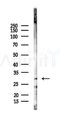 DDIT3/CHOP Antibody - Western blot analysis of lysates from 293 cells(heat-shock 45min treatment), using DDIT3/CHOP Antibody at 1/1000 dilution.