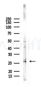 DDIT3/CHOP Antibody - Western blot analysis of lysates from B16F10-LUC cells(LPS 4h treatment), using DDIT3/CHOP Antibody at 1/1000 dilution.