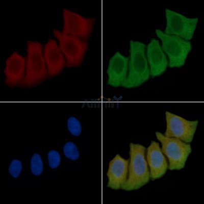VEGFR2 Antibody - AF6281 staining Hela cells(30min of UV treatment) by IF/ICC.