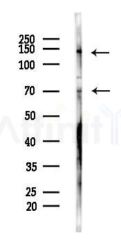 SREBP1 Antibody - Western blot analysis of lysates from Rat muscle, using SREBP1 Antibody at 1/1000 dilution.
