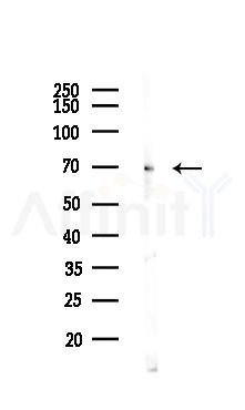 PPAR gamma Antibody - Western blot analysis of lysates from Hela cells(LPS 4h treatment), using PPAR gamma Antibody at 1/1000 dilution.
