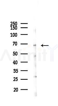 PPAR gamma Antibody - Western blot analysis of lysates from COLO205 cells(starvation 24h treatment), using PPAR gamma Antibody at 1/1000 dilution.