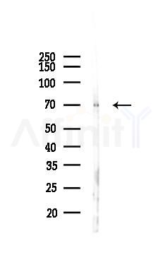 PPAR gamma Antibody - Western blot analysis of lysates from A2780 cells(LPS 4h treatment), using PPAR gamma Antibody at 1/1000 dilution.